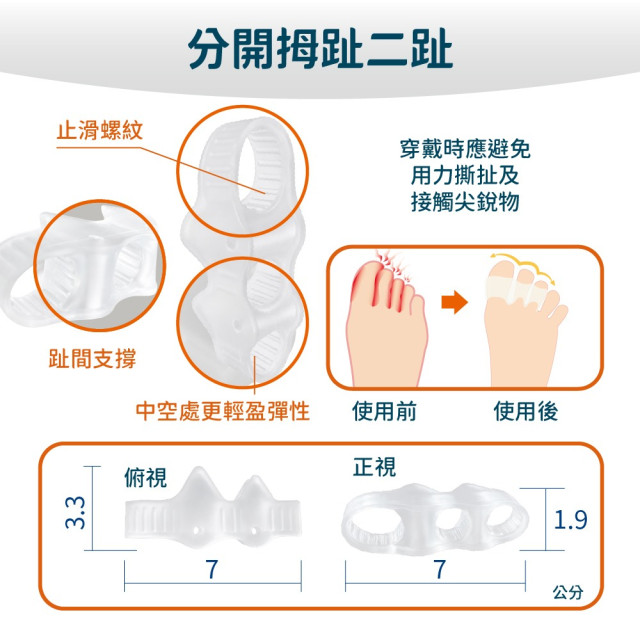 前三趾分趾器